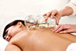 cupping therapy2 pic