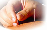 acupuncture2 pic